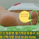 발가락운동용구 듀트 착용하고 걷고 10년넘게 고생한 지간신경종이 좋아졌어요 이미지