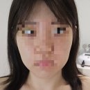 이천 윤곽관리 디테일한 후기 <헤르츠 뷰티라운지> 뉴소닉 초음파 피부관리와 수기 물방울 리프팅까지