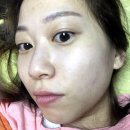 인진사이언스 | [임블리코스메틱] SOS진정앰플 리얼 후기