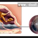 [한방 이비인후과] 귓병이 잘 안 낫는 이유?? 이미지