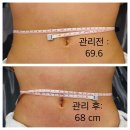 소삼로 | 소사역 피부샵 올가드림뷰티 2탄, 복부 순환 &amp; PDRN 관리후기 with 내돈내산