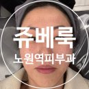 노원역 6번출구 | 노원역피부과 쥬베룩 스킨부스터 내돈내산 후기