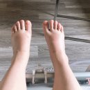 강블맥 | 동탄제일병원 박문일교수님 더블맥수술 후기