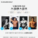 강남역 두피문신 SMP 스칼렌스칼프가 알려주는 꿀팁