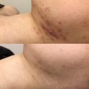 쁨단미피부전문센터 | 노원피부관리 트러블 고민 쁨단미 케어 후기
