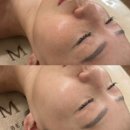 다산 피부관리 미올뷰티 마이크로젯_럭셔리재생관리 받고온후기