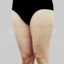 아트라인성형외과의원 이미지