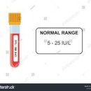 혈액검사 CPK CRP 수치 높으면 발생되는 질환 정상수치 기준 이미지