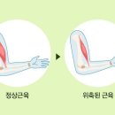 병뚜껑