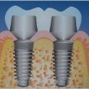 보스톤PC 이미지