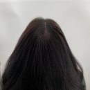 구미 가르마 탈모커버 더블라인스칼프 내돈내산 후기 가르마 넓어져서 신경 쓰일 때 선택