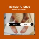 비포앤애프터 | 송파산후케어 산후마사지 시기와 비포앤애프터 후기