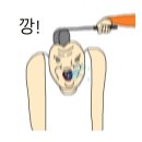메디누리요양병원 | 보호대+반깁스를 동시에 활용할 수 있는 포켓요깁스(PORKET YOGIPS)