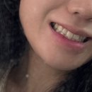 서울더스마일치과의원 | [예신관리] 치아미백 받고 온 직후 후기 :) 레브치과 신사역 치아미백 솔직 후기