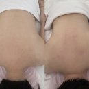 [수원] 피부이야기 : 수원거북목 관리 호매실피부관리 후기