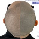 탈모왕 광주점 이미지