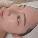 캔디피부관리실 네이버블로그