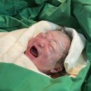 원주 우리 산부인과 OR 프리티가든 산후조리원 출산부터 산후조리까지 (1~4일차) 제왕절개 후기
