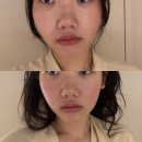 아르테 | 성수 신부관리 붓기관리로 추천드리는 아르테에스테틱 방문 후기