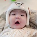 등대길 (중3-7) | [육아일기]두상교정중 하니헬멧 3주 착용 후기 7개월 아기