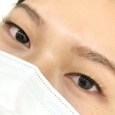 눈, 여기다 이미지