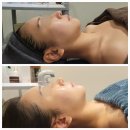 서윤피부맑음 명동점 | 명동피부관리 | 서윤피부맑음 명동점, 3D입체관리 웨딩관리 후기