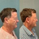 휴병원(급식실 포함) | 서울안면거상병원 고를 때 무엇을 봐야 할까? 후기·가격·효과 기준