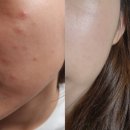 태리약국 | &lt;역대급 할인가!!&gt; 스팟 컨트롤 크림 6+2개 더 구성! 1개당 19750원!!