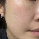 압토솔 | 유산균미스트 압토솔 예민피부 수분진정 후기