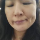 내돈 내산 절개 보조개 시술 실제 후기