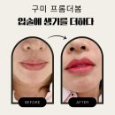 옥계2공단로2-30 | 【구미】 산동옥계 입술문신_입술에 생기로 환해진 얼굴_프롬더봄