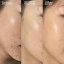 피우리플라워 | 부산 피부관리 웨딩케어 촬영 직전에 추천하는 세라피스파 플라소노 브라이트닝