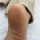 다시온리케어 | 수원 발각질 관리 발만 전문으로 케어해주는 온리풋 솔직후기