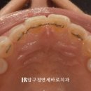 젤라 이미지