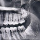 정성플란트치과의원 이미지