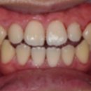 서울산성플란트치과의원 이미지