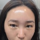 안경명가 | 남양주 오남 피부샵 Lee 약손명가 후기｜출산 후 푸석한 피부, 비타민수분·PDT 맞춤광파케어