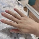 안양산부인과 산본제일병원 생생한 제왕절개 1-5일차 후기 (잊지말자, 이 고통!)