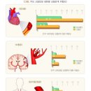 고혈압(원발성)치료비(1회한) 특별약관 이미지