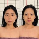 명동에너지 | 명동 피부관리 올리즈에스테틱, 수기+에너지테라피 윤곽관리 후기