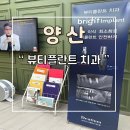 평산뷰티플란트치과의원 | 양산 임플란트 한 후기 뷰티플란트