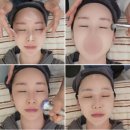 옥계신당로-9 | ✨구미 옥계 피부관리 찐후기✨ 수분광 미쳤다… 1:1 맞춤관리 + 이어테라피까지 730스킨 다녀온 썰💗
