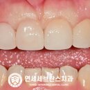 스마일디자인 치과기공소 이미지