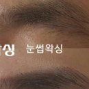 비엘왁싱