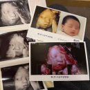 (주)해내 | [임신 28주차 ~ 36주차] 임신 후기 1탄