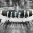 네이치과기공소 이미지