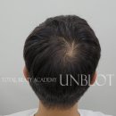언블럿 네이버블로그