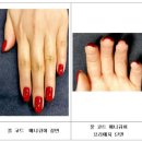 클리퍼네일 이미지