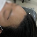 헤어로운날 | 청주헤어라인 보테브로우바스튜디오 자연스러운 잔머리 반영구 솔직후기
