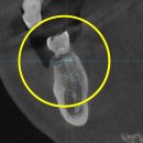 동탄가온치과의원 이미지